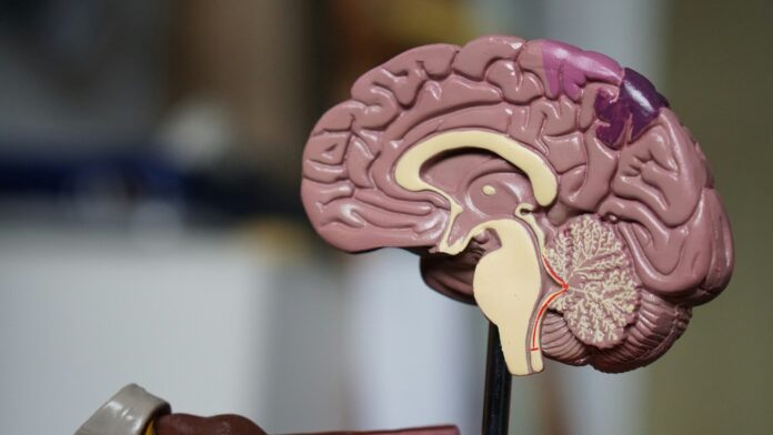brain-model An anatomical model of a human brain